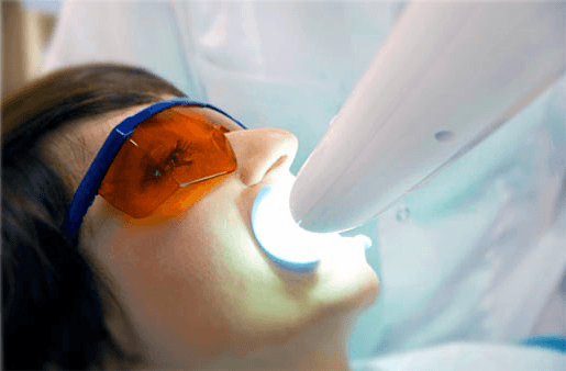 Understanding the Causes of Teeth Sensitivity Cannock