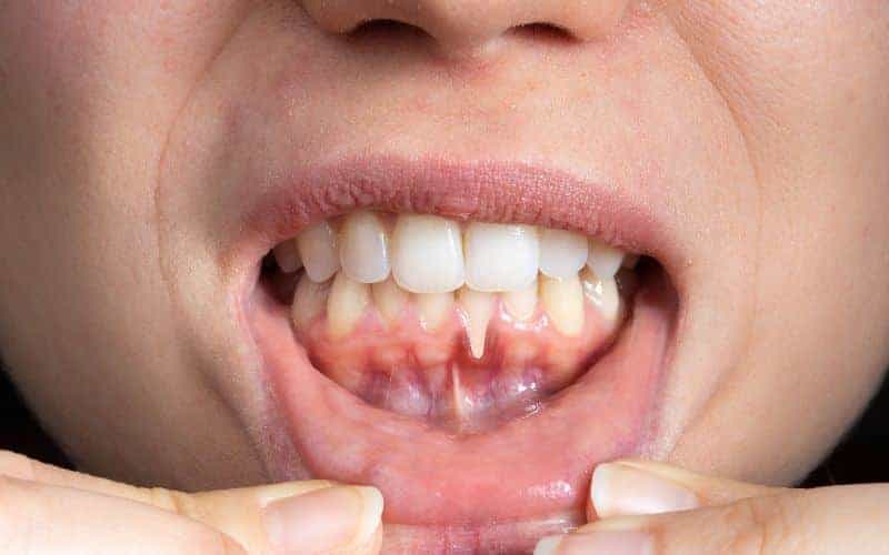 Final Thoughts: Building Lifelong Enamel Protection Habits Cannock