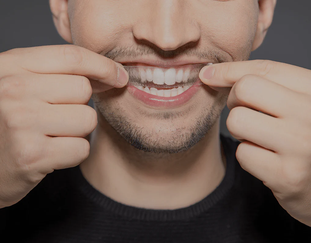 What to Consider Before Choosing a Teeth Whitening Option Cannock