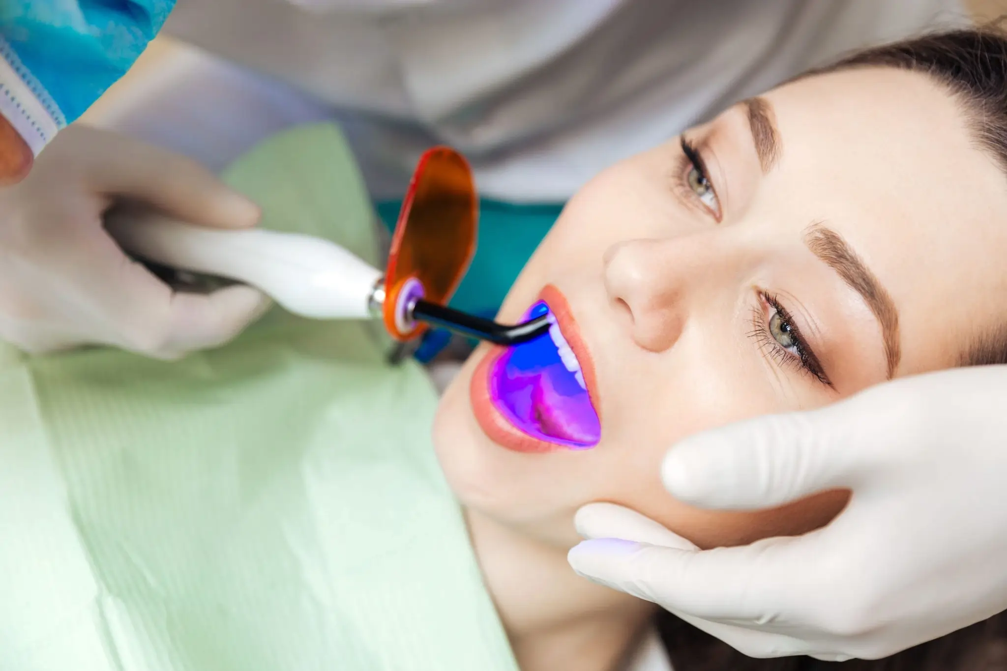 When Should You Stop DIY Whitening and Consider Professional Treatment Instead Cannock?