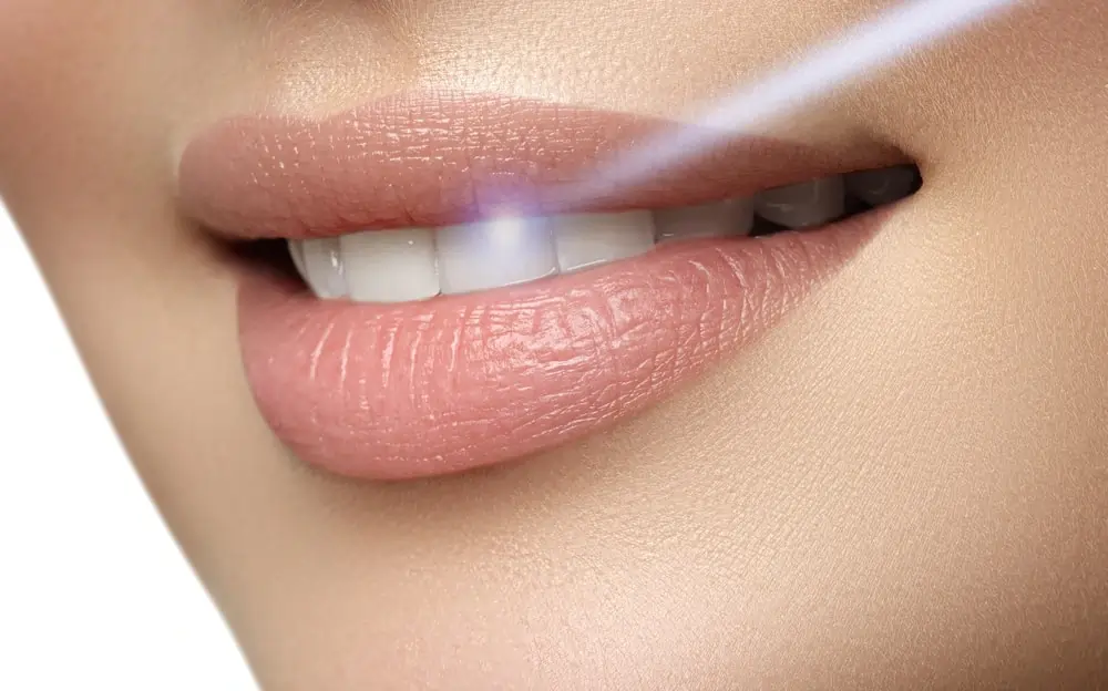Understanding Teeth Whitening Risks and Results Cannock