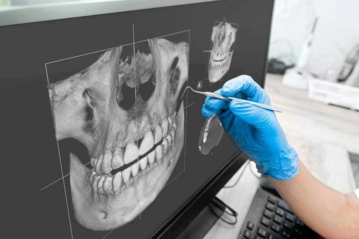 Key Benefits of 3D Printing for Patients and Dentists Cannock
