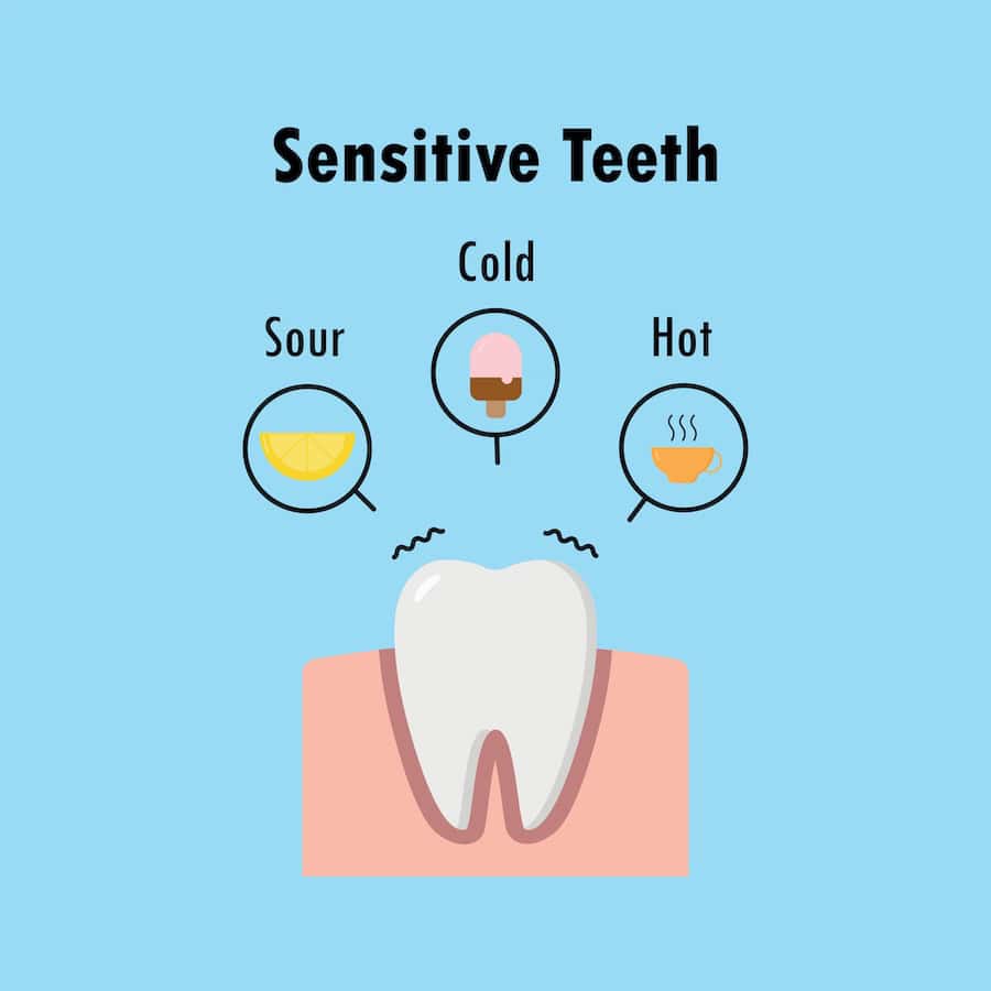 How Can You Tell If Your Teeth Are Becoming Sensitive Cannock?