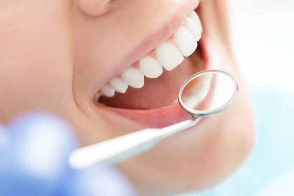 How Much Fluoride Do You Really Need Cannock?