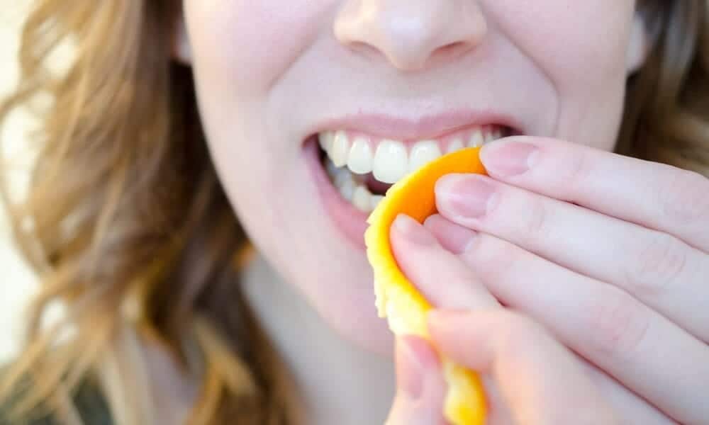 Are DIY Teeth Whitening Remedies Safe for Your Teeth and Enamel Cannock?