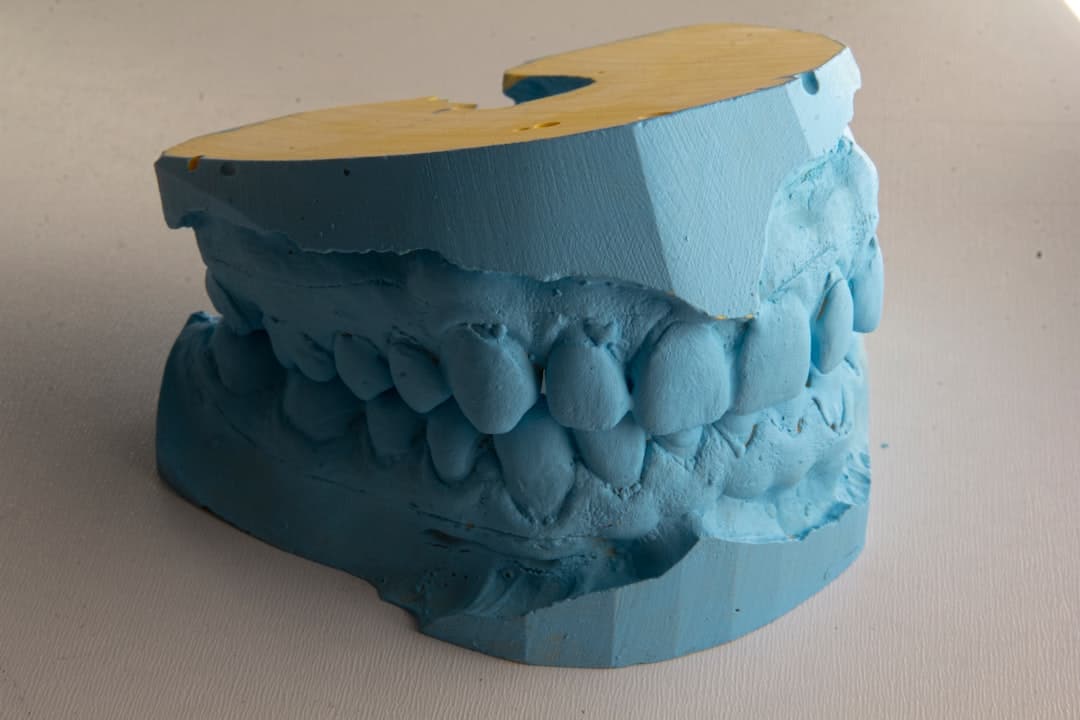 How Do Dental Implants Improve Jawbone Health and Oral Function Cannock?