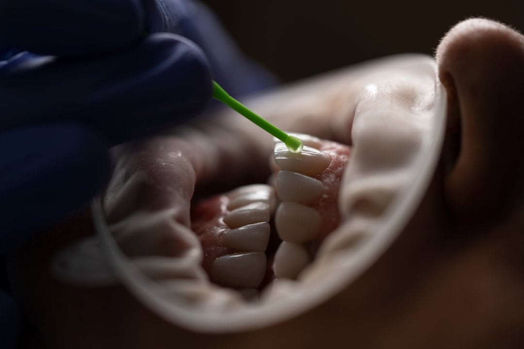 Common Causes of Persistent Dry Mouth Cannock