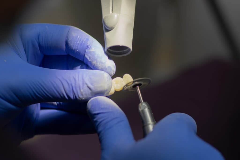 Customised Dental Solutions: Crowns, Aligners, and Implants Cannock