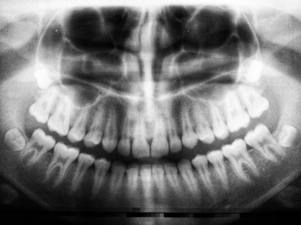 The Future of 3D Printing in Oral Healthcare Cannock